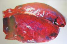 图4 肺脏淤血、水肿